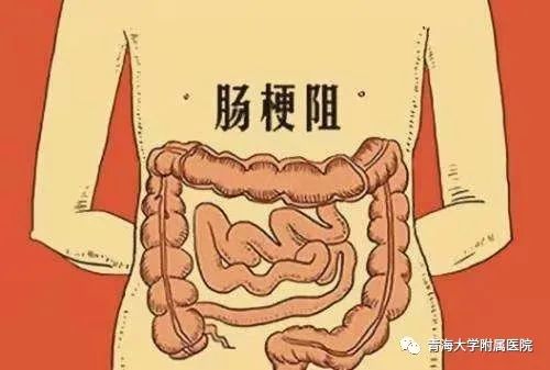 粘连性肠梗阻饮食注意_肠饮食粘连性梗阻注意事项_肠饮食粘连性梗阻注意哪些事项