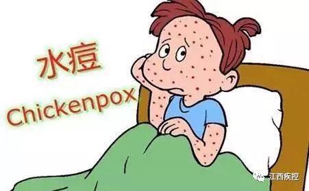 成人水痘饮食-成人水痘饮食食谱