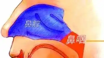 鼻咽癌化疗后的饮食-鼻咽癌 遗传性 治疗方法